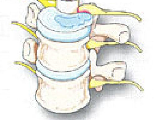 ROCKTOBER SPECIAL ..KEEP YOUR BONES STRONG