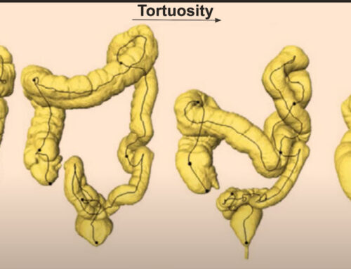 The PFAS Chemical Test Overview-The Poison in Us All